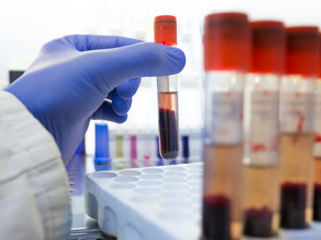 Abivax je nova europska zvijezda, dionica skočila 1300 posto