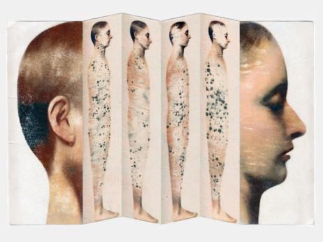 Kako COVID-19 potiho preoblikuje mozak